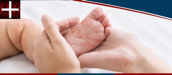 Pediatric Rash and Infection Treatment Near Me in Denton TX