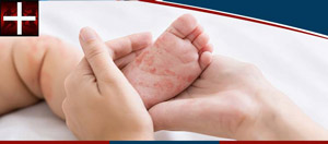 Pediatric Rash and Infection Treatment Near Me in Denton TX