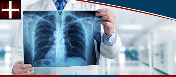 X Ray Cost Near Me in Denton TX X Ray Cost Near Me in Denton TX