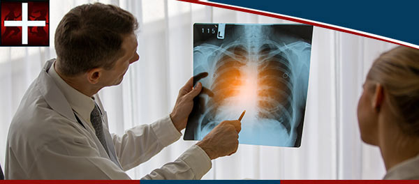 What an X-Ray Can Show About Your Health | Minor Emergency of Denton TX What an X-Ray Can Show About Your Health | Minor Emergency of Denton TX