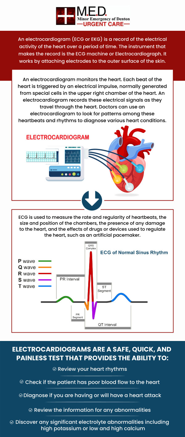 An EKG is a rapid and painless test that a medical professional can do to monitor your heart rhythm and assess your heart. It is used for determining whether or not a person is at substantial risk of having a potentially life-threatening cardiac arrhythmia. At Minor Emergency of Denton, Dr. Andrew J. Blankenau, MD provides simple, low-cost EKG testing to check your heart and screen for any cardiac abnormalities. For more information, please contact us or simply walk in! We are conveniently located at 4400 Teasley Ln #200 Denton, TX 76210.