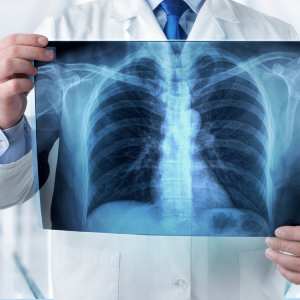 X-Ray & Labs Near Me in Denton, TX